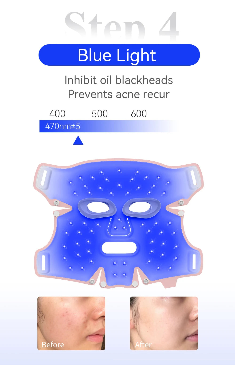 ANLAN LED Facial Mask | 5‑Color LED, Silicone, Anti‑Aging, Heating Photon Therapy