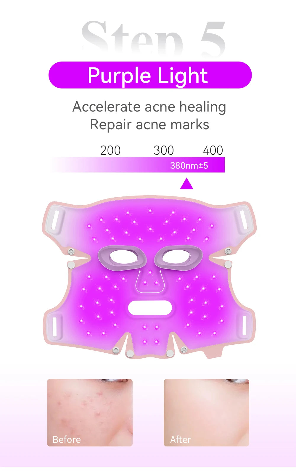 ANLAN LED Facial Mask - 5 Color Silicone Waterproof Thermotherapy for Anti-Aging, Skin Rejuvenation, and Brightening - Limetastore