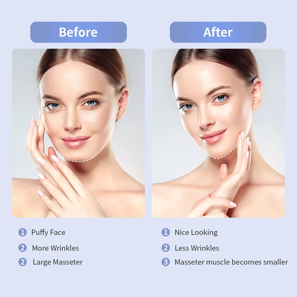ANLAN V‑Face Lifting Device | EMS, Red/Blue Light, Heat, Double‑Chin Reduction