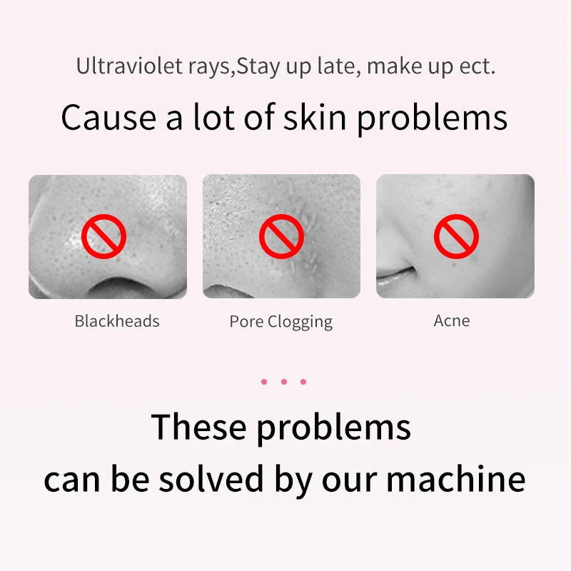 ANLAN Ultrasonic Skin Scrubber | Deep Cleaning, Peeling, EMS Lifting, Facial Shovel
