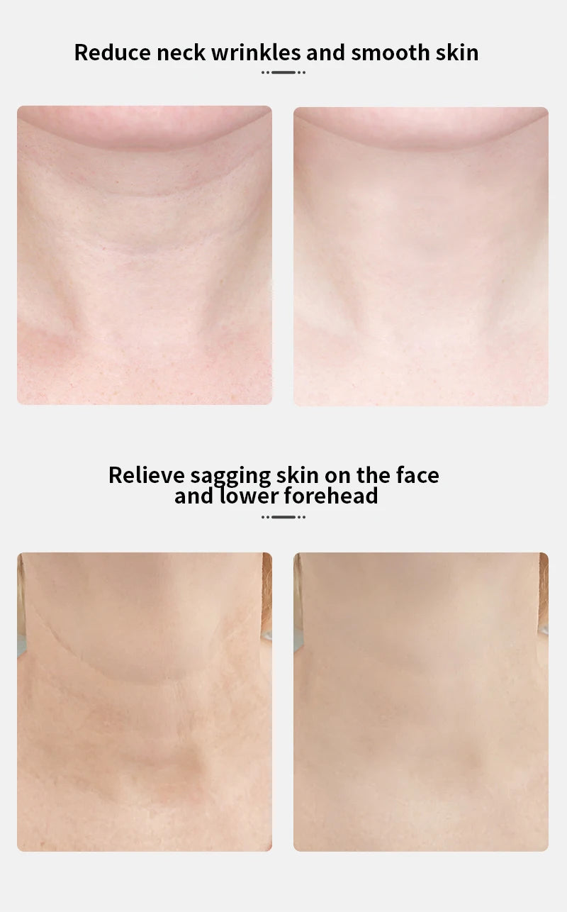 ANLAN Neck & Face Beauty Device | EMS Lifting, 3‑Color Light, Double‑Chin Reduction