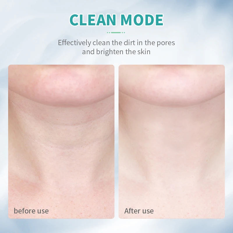 ANLAN Neck Lifting Beauty Device – EMS Facial Neck Tightening, 3 Colors Light Skin Care Tool to Reduce Double Chin - Limetastore