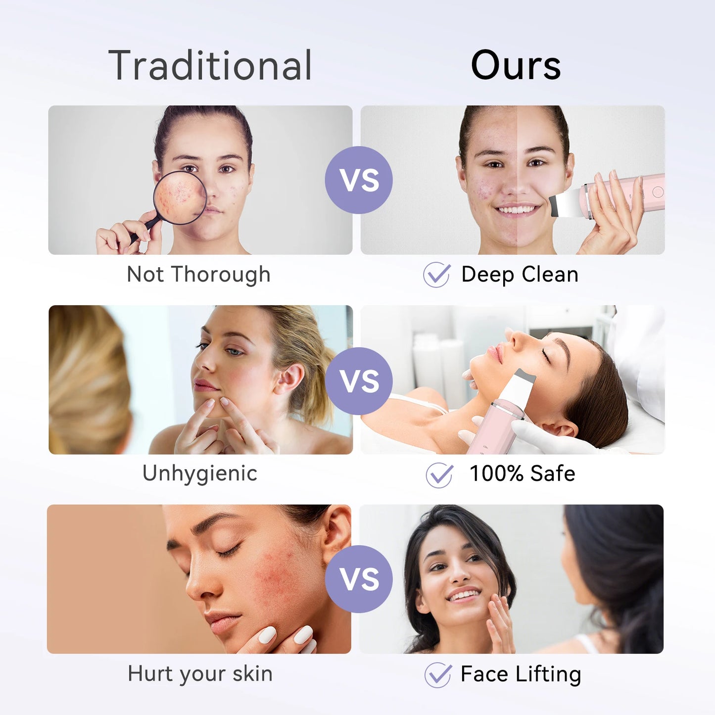 ANLAN Ultrasonic Skin Scrubber | EMS Lifting, Deep Cleansing, Ultrasonic Peeling