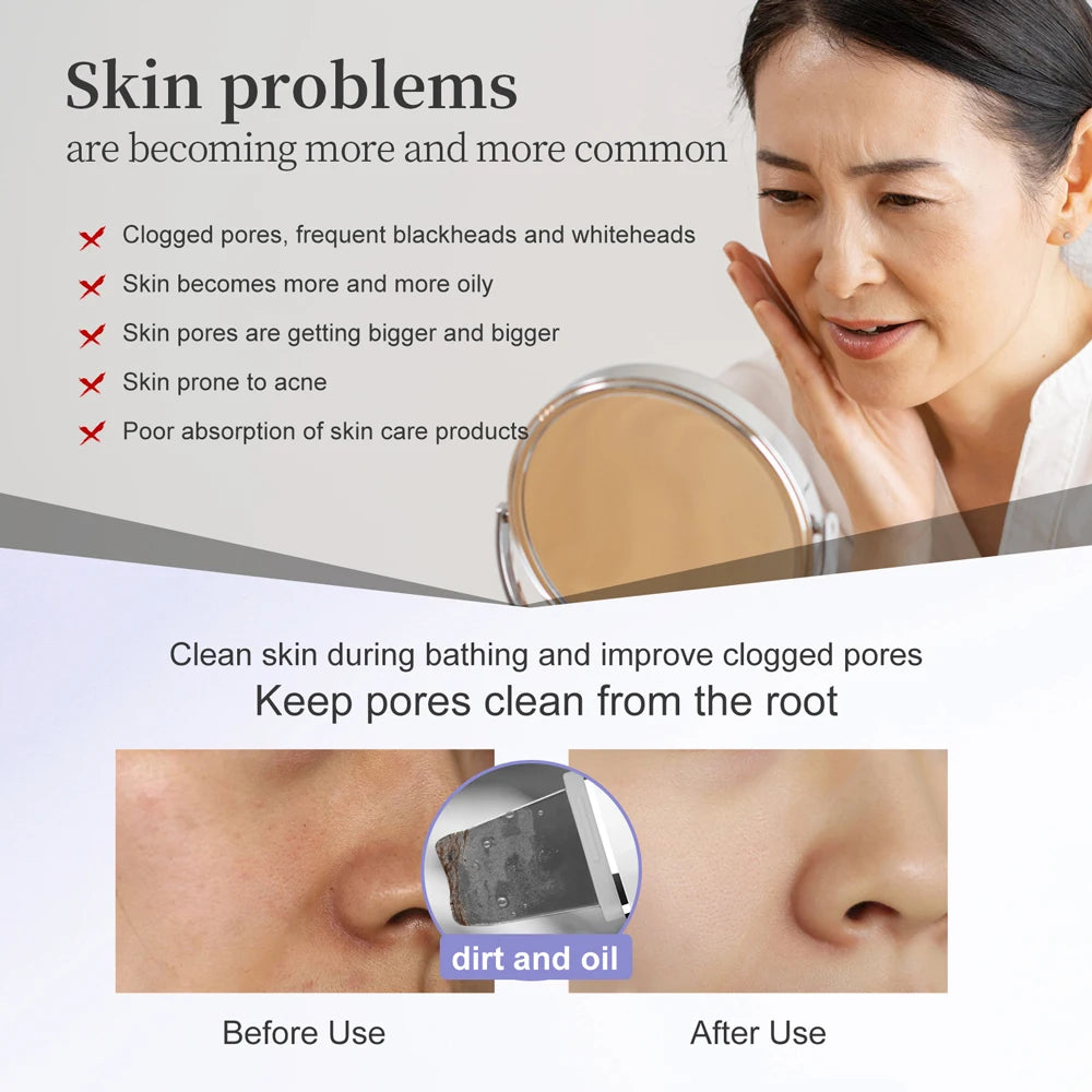 ANLAN Ultrasonic Skin Scrubber | EMS Lifting, Red/Blue LED, Deep Cleansing, IPX7