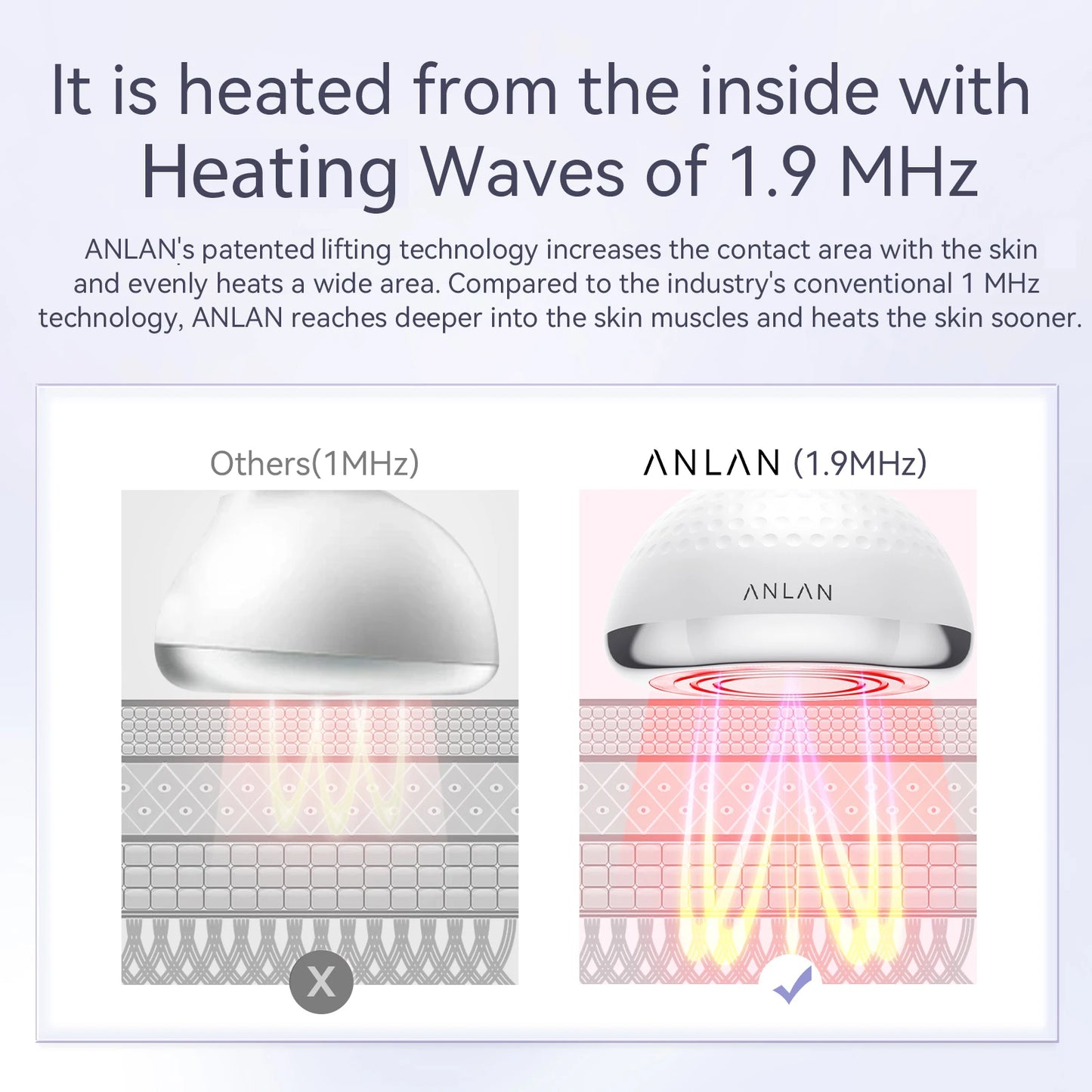 ANLAN RF Slimming Machine | 5‑in‑1 EMS Cavitation Fat Burner