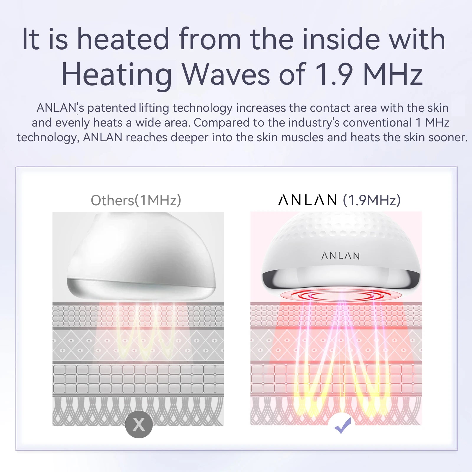 ANLAN RF Slimming Machine | 5‑in‑1 EMS Cavitation Fat Burner