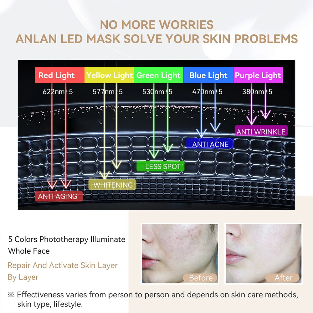 ANLAN LED Facial Mask | 5‑Color LED, Silicone, Anti‑Aging, Heating Photon Therapy