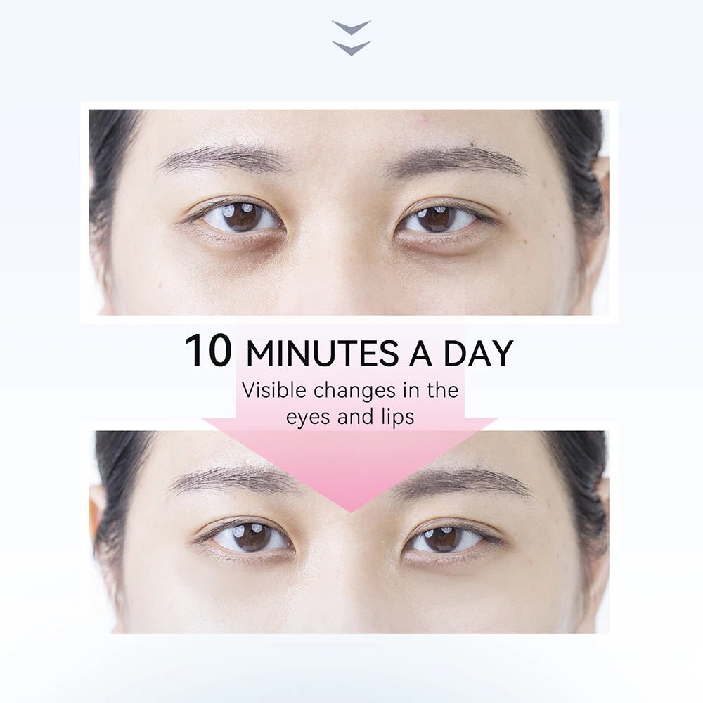ANLAN EMS Eye Beauty Device | Microcurrent, Red/Blue LED, Eye Bags & Dark Circles